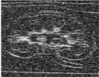 fig4bcd
