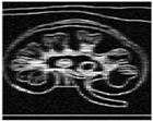 fig4efg